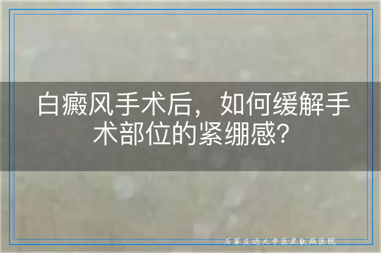 白癜风手术后，如何缓解手术部位的紧绷感？