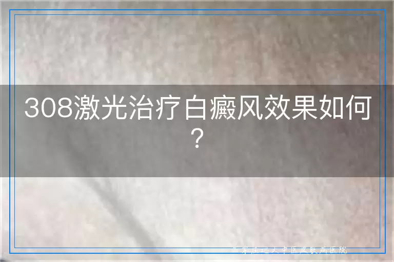 308激光治疗白癜风效果如何？