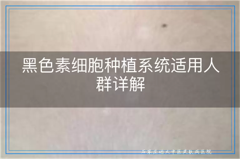 黑色素细胞种植系统适用人群详解
