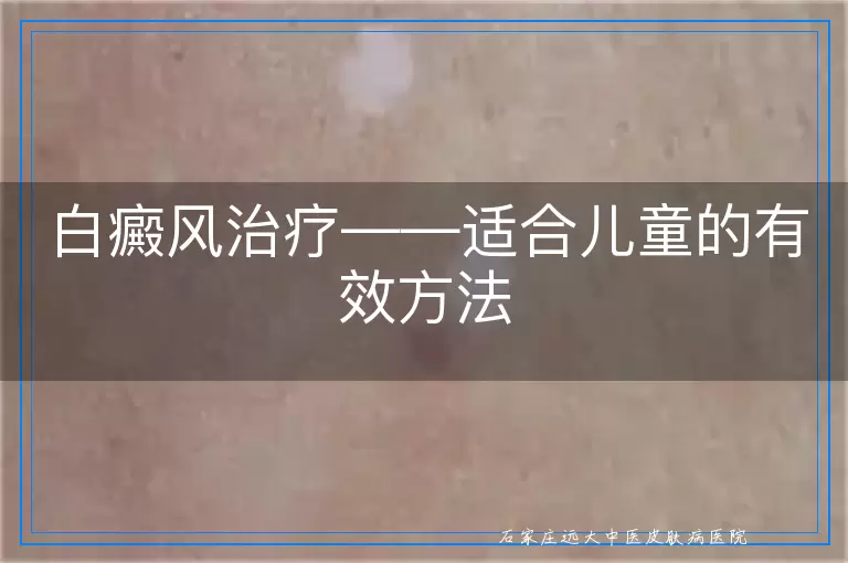 白癜风治疗——适合儿童的有效方法