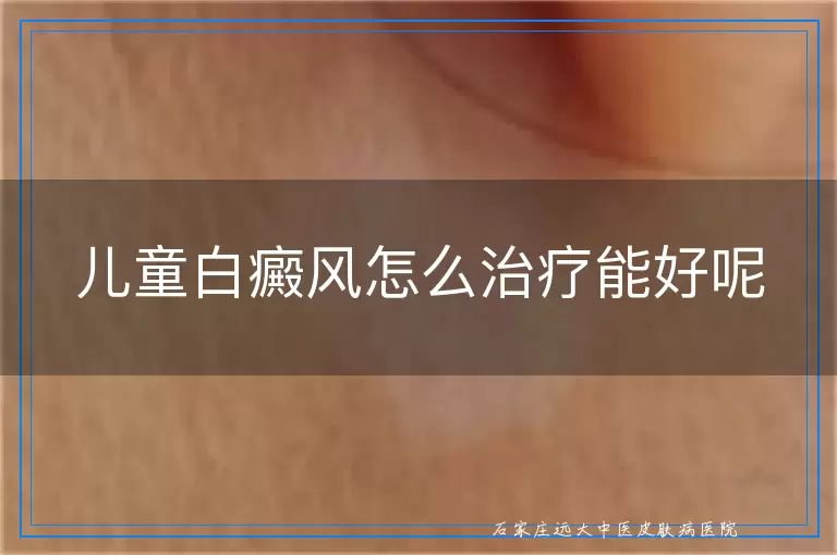 儿童白癜风怎么治疗能好呢
