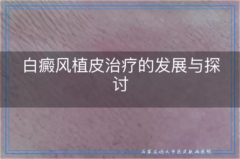 白癜风植皮治疗的发展与探讨
