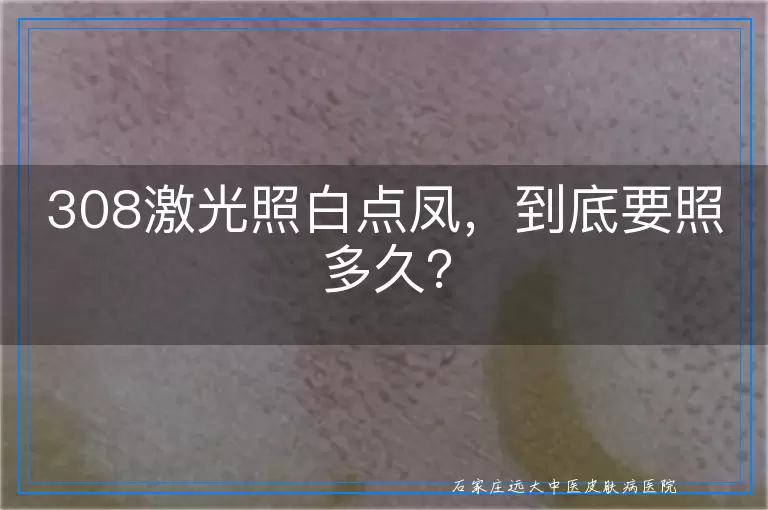 308激光照白点凤，到底要照多久？