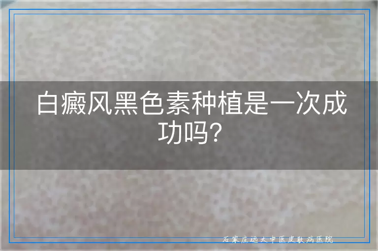 白癜风黑色素种植是一次成功吗？