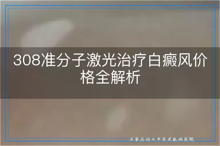 308准分子激光治疗白癜风价格全解析