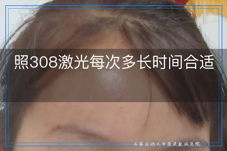照308激光每次多长时间合适