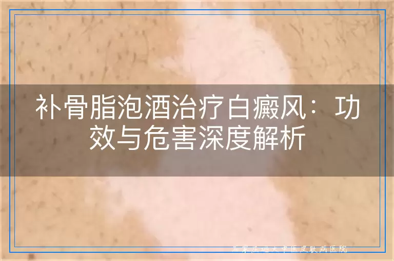 补骨脂泡酒治疗白癜风：功效与危害深度解析