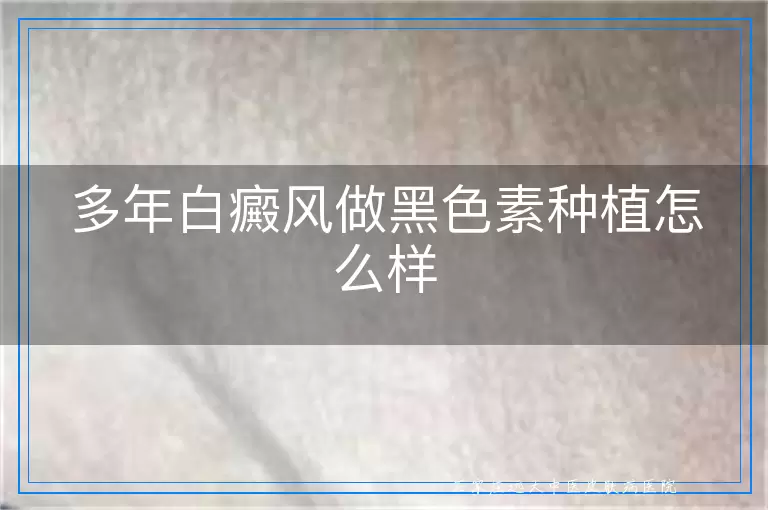 多年白癜风做黑色素种植怎么样