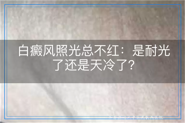 白癜风照光总不红：是耐光了还是天冷了？