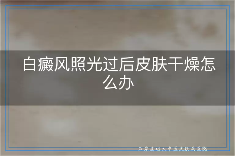白癜风照光过后皮肤干燥怎么办