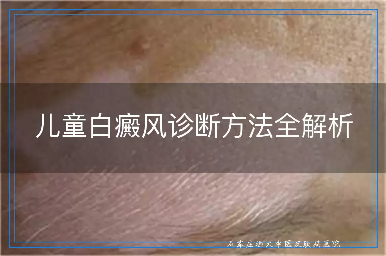 儿童白癜风诊断方法全解析