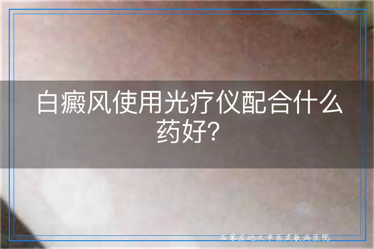 白癜风使用光疗仪配合什么药好？