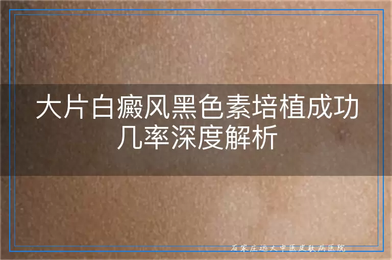 大片白癜风黑色素培植成功几率深度解析