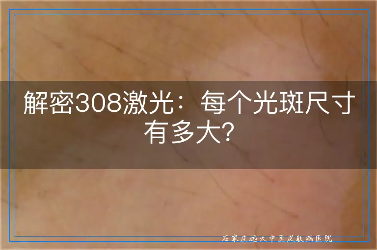 解密308激光：每个光斑尺寸有多大？