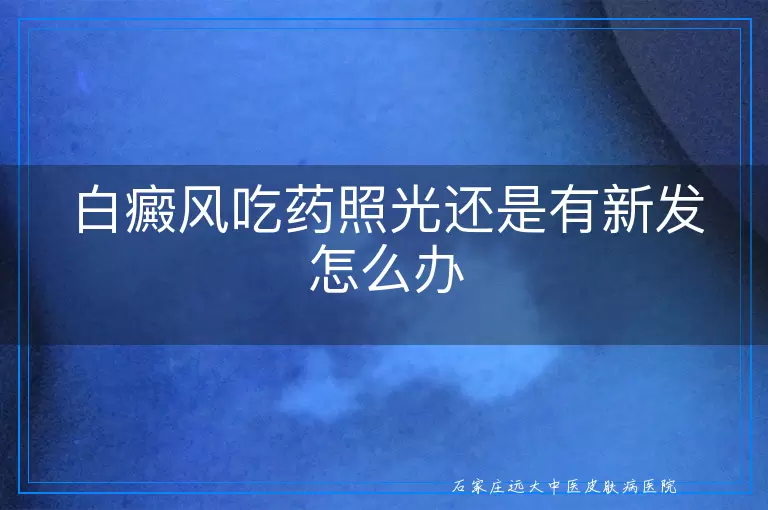 白癜风吃药照光还是有新发怎么办