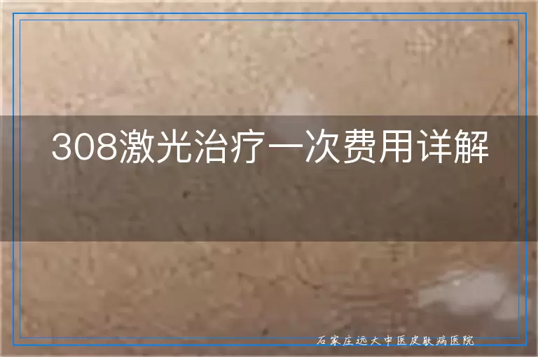 308激光治疗一次费用详解