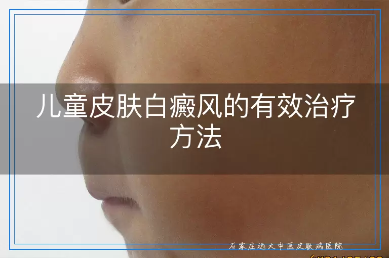 儿童皮肤白癜风的有效治疗方法