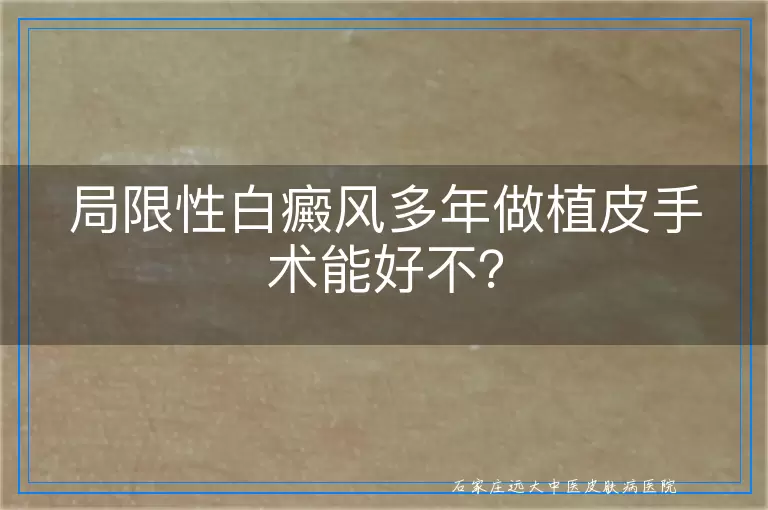 局限性白癜风多年做植皮手术能好不？