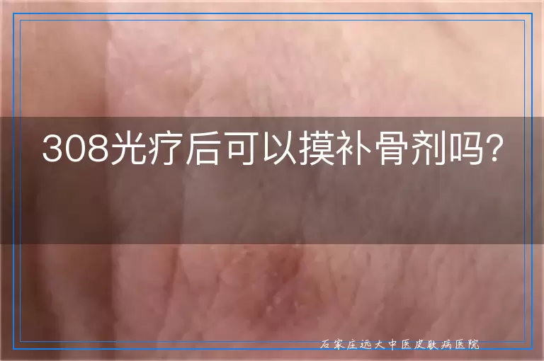 308光疗后可以摸补骨剂吗？