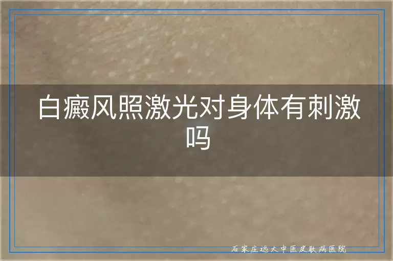 白癜风照激光对身体有刺激吗