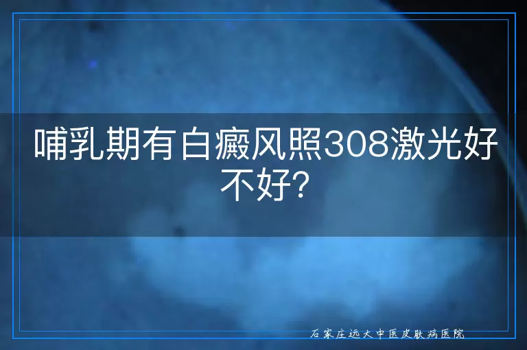 哺乳期有白癜风照308激光好不好？