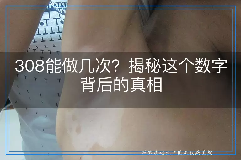 308能做几次？揭秘这个数字背后的真相
