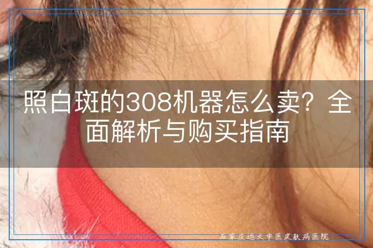 照白斑的308机器怎么卖？全面解析与购买指南