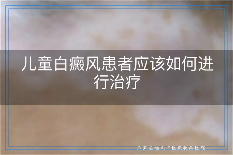 儿童白癜风患者应该如何进行治疗