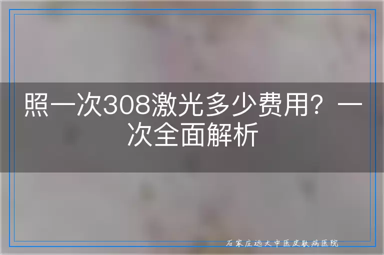 照一次308激光多少费用？一次全面解析
