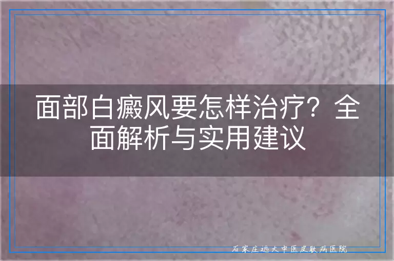 面部白癜风要怎样治疗？全面解析与实用建议