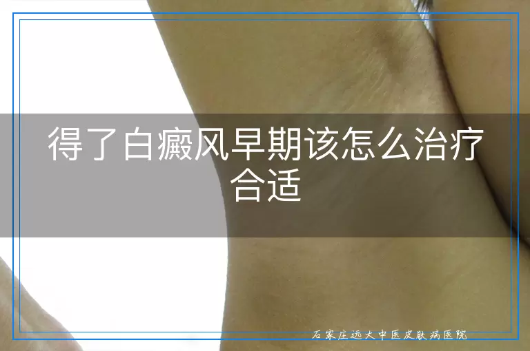 得了白癜风早期该怎么治疗合适