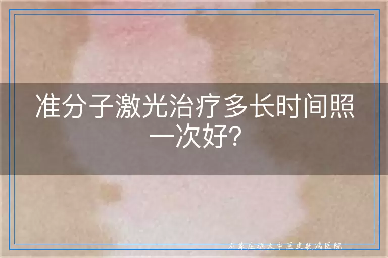 准分子激光治疗多长时间照一次好？