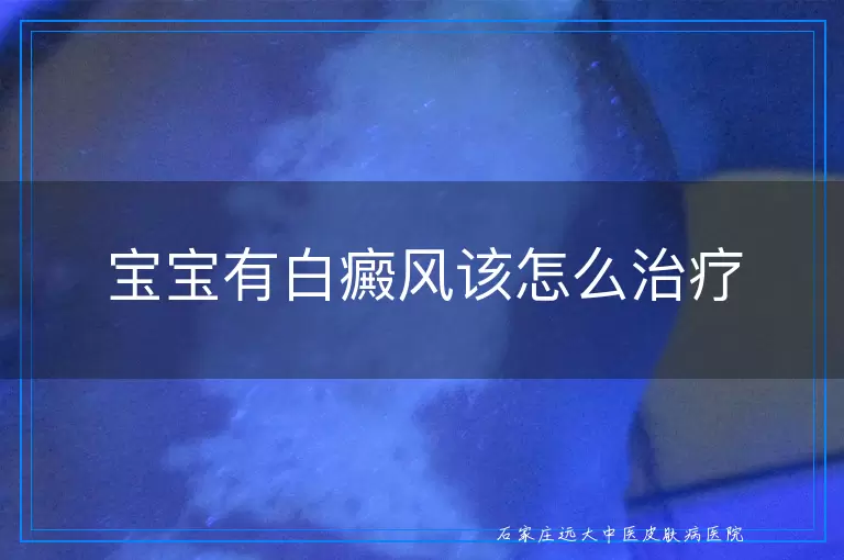 宝宝有白癜风该怎么治疗