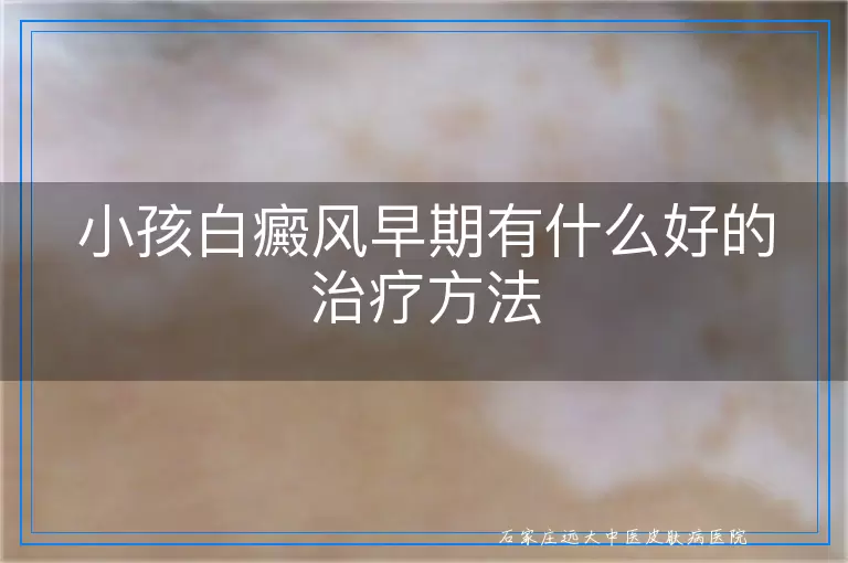 小孩白癜风早期有什么好的治疗方法