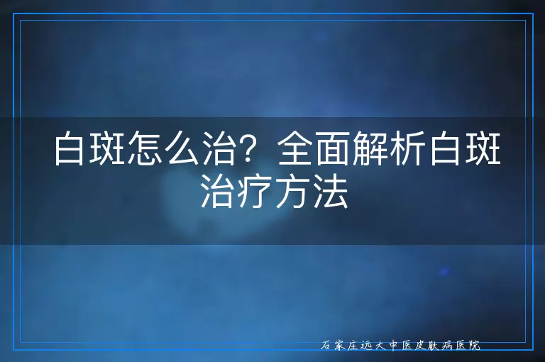 白斑怎么治？全面解析白斑治疗方法