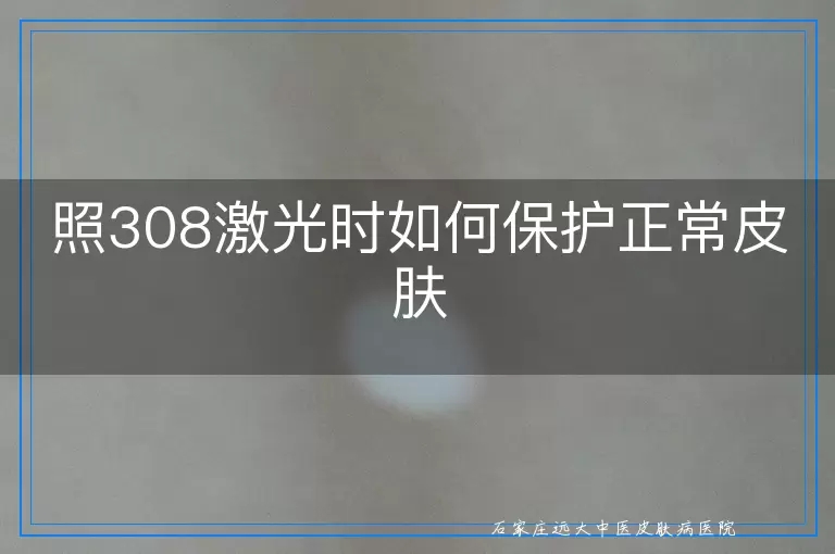照308激光时如何保护正常皮肤