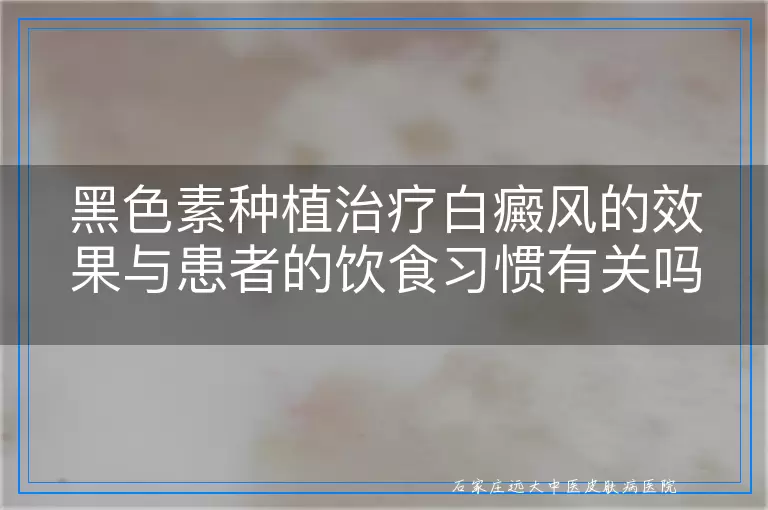 黑色素种植治疗白癜风的效果与患者的饮食习惯有关吗