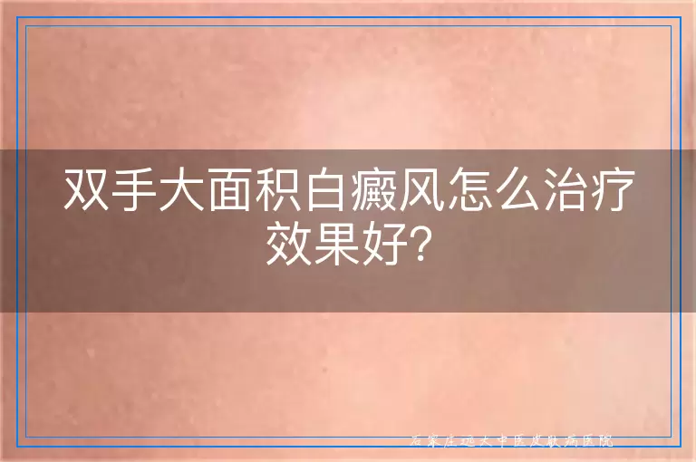 双手大面积白癜风怎么治疗效果好？