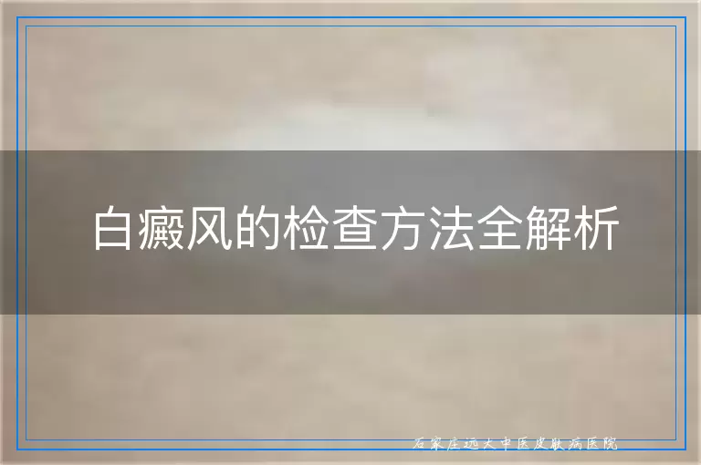 白癜风的检查方法全解析