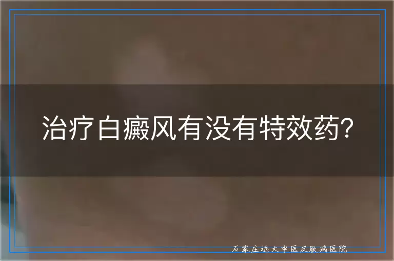 治疗白癜风有没有特效药？