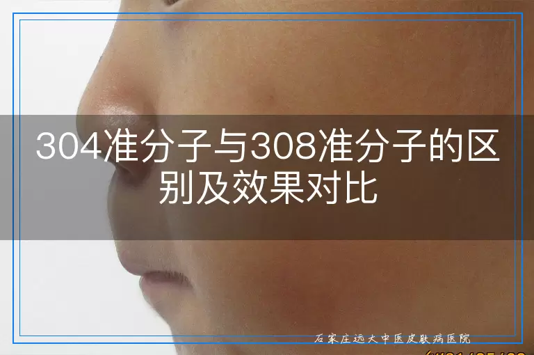 304准分子与308准分子的区别及效果对比