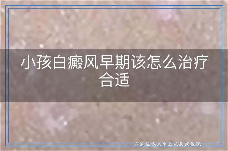 小孩白癜风早期该怎么治疗合适