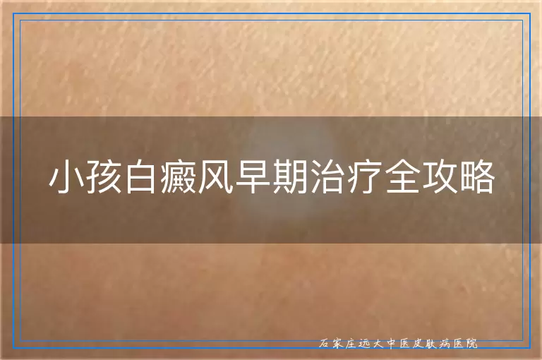 小孩白癜风早期治疗全攻略