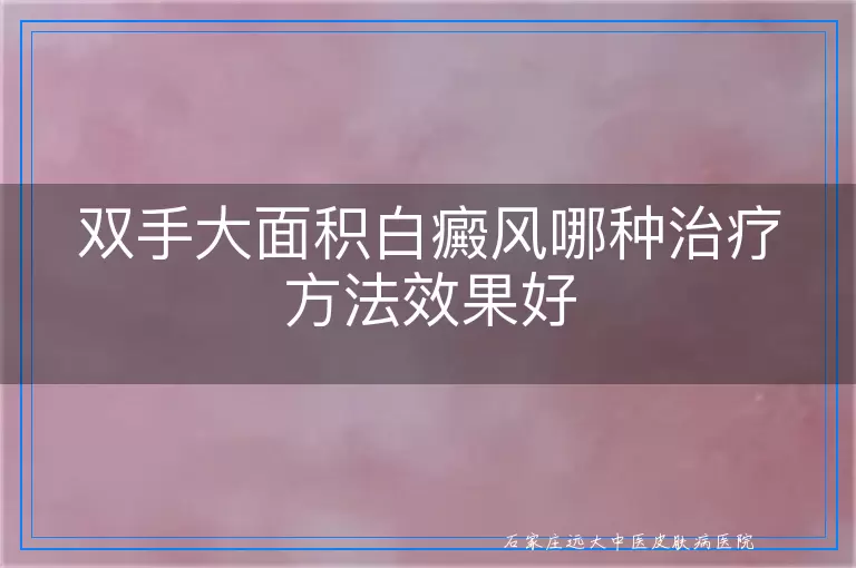 双手大面积白癜风哪种治疗方法效果好
