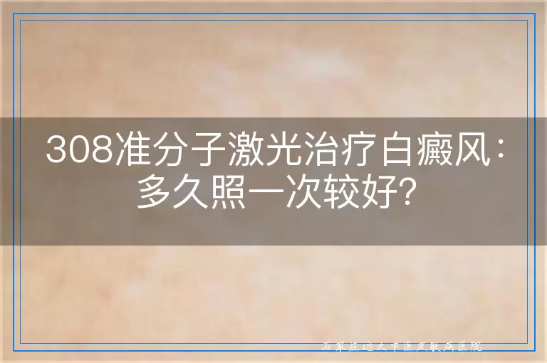 308准分子激光治疗白癜风：多久照一次较好？