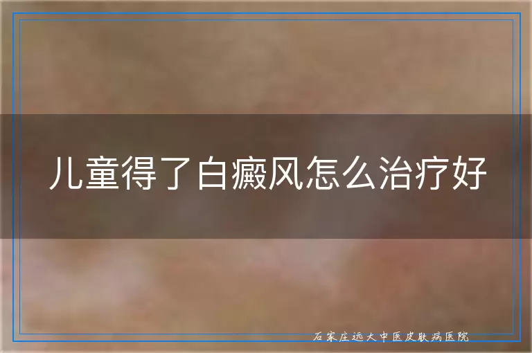 儿童得了白癜风怎么治疗好