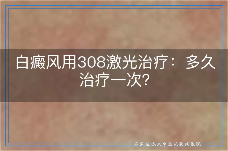 白癜风用308激光治疗：多久治疗一次？