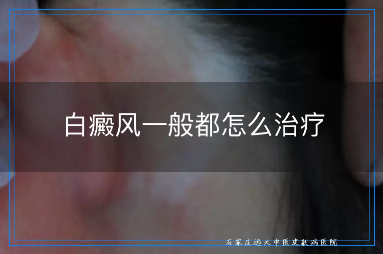 白癜风一般都怎么治疗