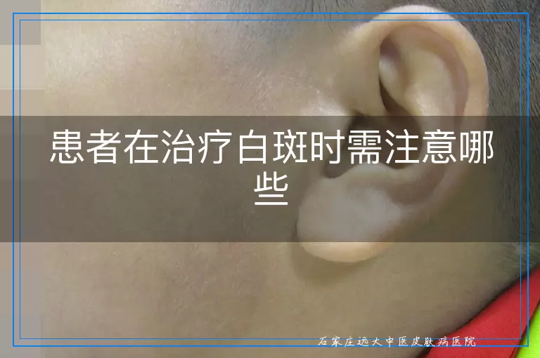 患者在治疗白斑时需注意哪些