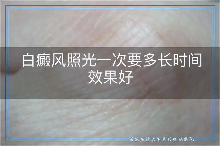 白癜风照光一次要多长时间效果好